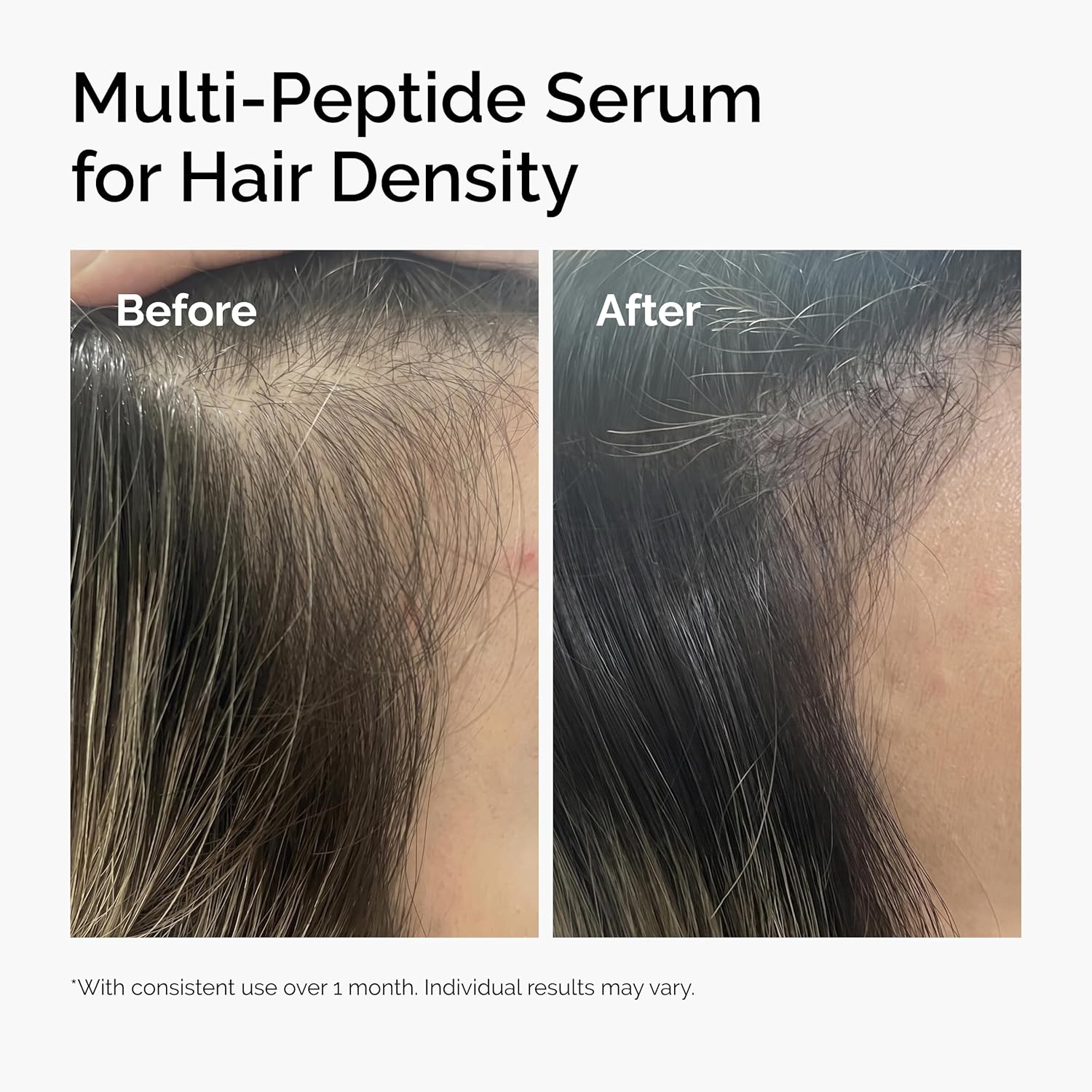 image:imageThe Ordinary MultiPeptide Serum for Hair Density PeptidePowered Formula for Thicker Fuller Looking Hair2 Fl Oz Pack of 1