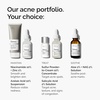 image:imageThe Ordinary Aloe 2  NAG 2 Solution Soothes Skin and Targets PostAcne Marks 1 Fl Oz