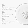 image:imageThe Ordinary Aloe 2  NAG 2 Solution Soothes Skin and Targets PostAcne Marks 1 Fl Oz