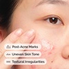image:imageThe Ordinary Aloe 2  NAG 2 Solution Soothes Skin and Targets PostAcne Marks 1 Fl Oz