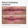 image:imageThe Ordinary Lip Care Duo  Skin Care Bundle Set  PHA 5 Exfoliating Lip Serum 05 Fl Oz  Squalane and Amino Acids Lip Balm