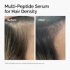 image:imageThe Ordinary MultiPeptide Serum for Hair Density PeptidePowered Formula for Thicker Fuller Looking Hair2 Fl Oz Pack of 1