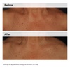 image:imageThe Ordinary Niacinamide 5 Face and Body Emulsion Dark Spot amp Skin Tone Corrector 34 Fl Oz