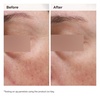 image:imageThe Ordinary Niacinamide 5 Face and Body Emulsion Dark Spot amp Skin Tone Corrector 34 Fl Oz