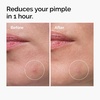 image:imageThe Ordinary Oil Control Duo Blemish Skin Care Set Niacinamide 10  Zinc 1 and Sulfur 10 PowderToCream Concentrate