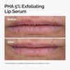 image:imageThe Ordinary PHA 5 Exfoliating Lip Serum Hydrating Overnight Lip Exfoliator Treatment 05 Fl Oz