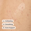 image:imageThe Ordinary Salicylic Acid 05 Body Serum Exfoliating Treatment for AcneProne Skin 81 Fl Oz