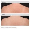 image:imageThe Ordinary Salicylic Acid 05 Body Serum Exfoliating Treatment for AcneProne Skin 81 Fl Oz