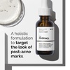 image:imageThe Ordinary Sensitive Skin Collection Skin Care BundleBlemishProne Skin Glucoside Foaming Cleanser Aloe 2  NAG 2 Solution Niacinamide 10  Zinc 1 Natural Moisturizing FactorsBeta Glucan