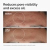 image:imageThe Ordinary Serum Favorites Set  Hyaluronic Acid 2  B5 Niacinamide 10  Zinc 1 Caffeine Solution 5  EGCG Eye Serum Serums for Hydrating Brightening amp PoreMinimizing Skin Care