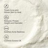 image:imageThe Ordinary Sulfur 10 PowdertoCream Acne Spot Treatment Concentrate Reduces Pimple Size and Zit Redness 018 Oz018 Ounce Pack of 1